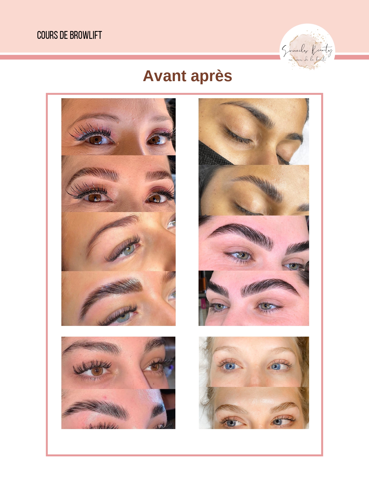 Extrait du livret de formation Browlift page 19